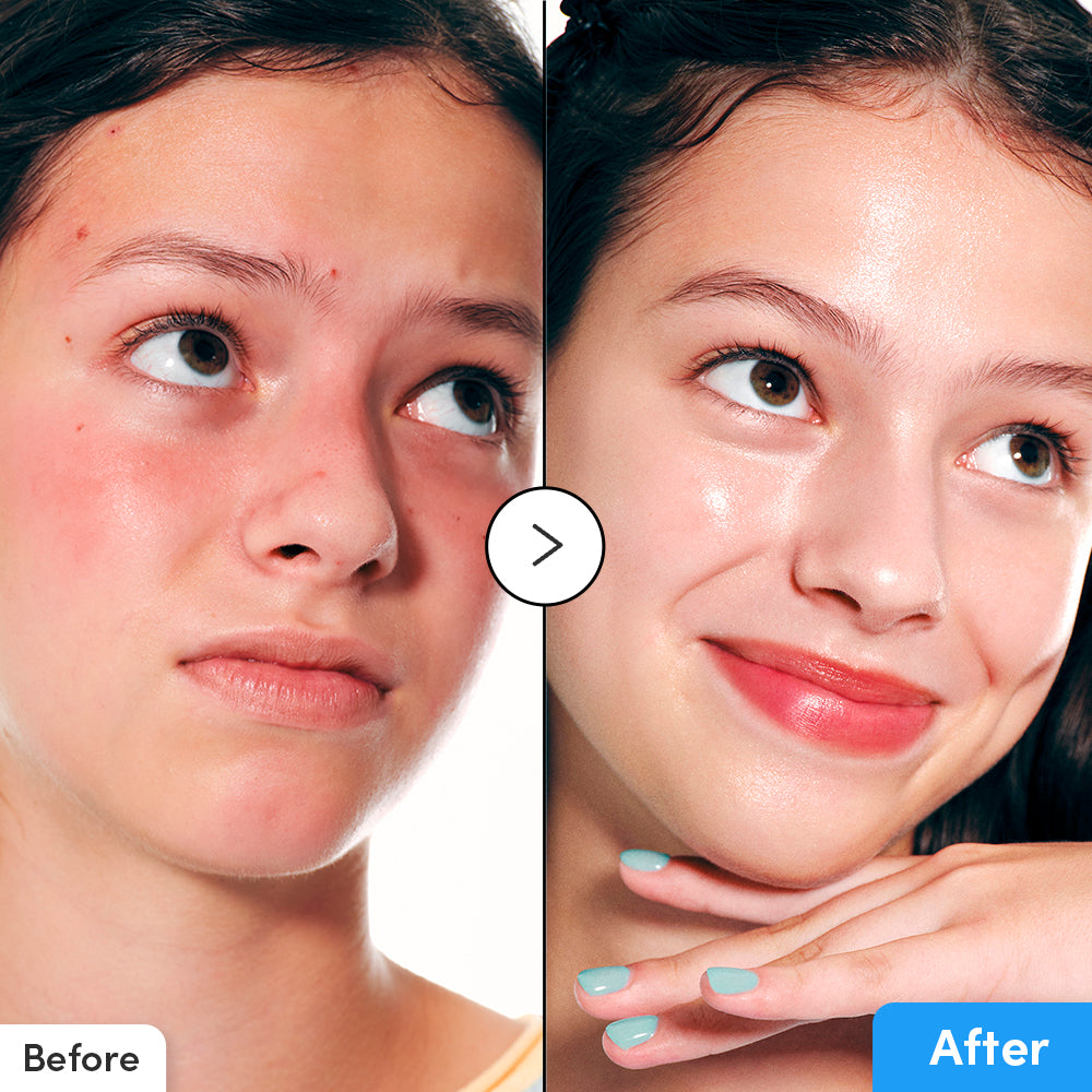 Hyaltoin Flooding Serum